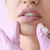 acido hialuronico aumento de labios relleno clinica estetica gliamori labios mujer inyección