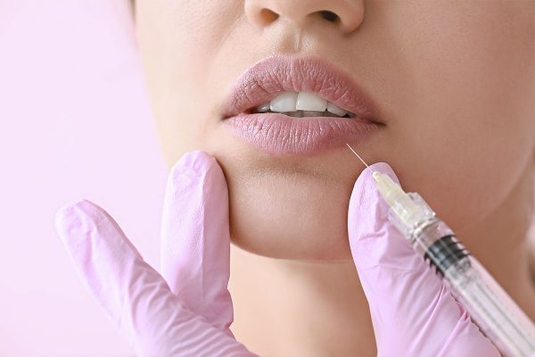 acido hialuronico aumento de labios relleno clinica estetica gliamori labios mujer inyección